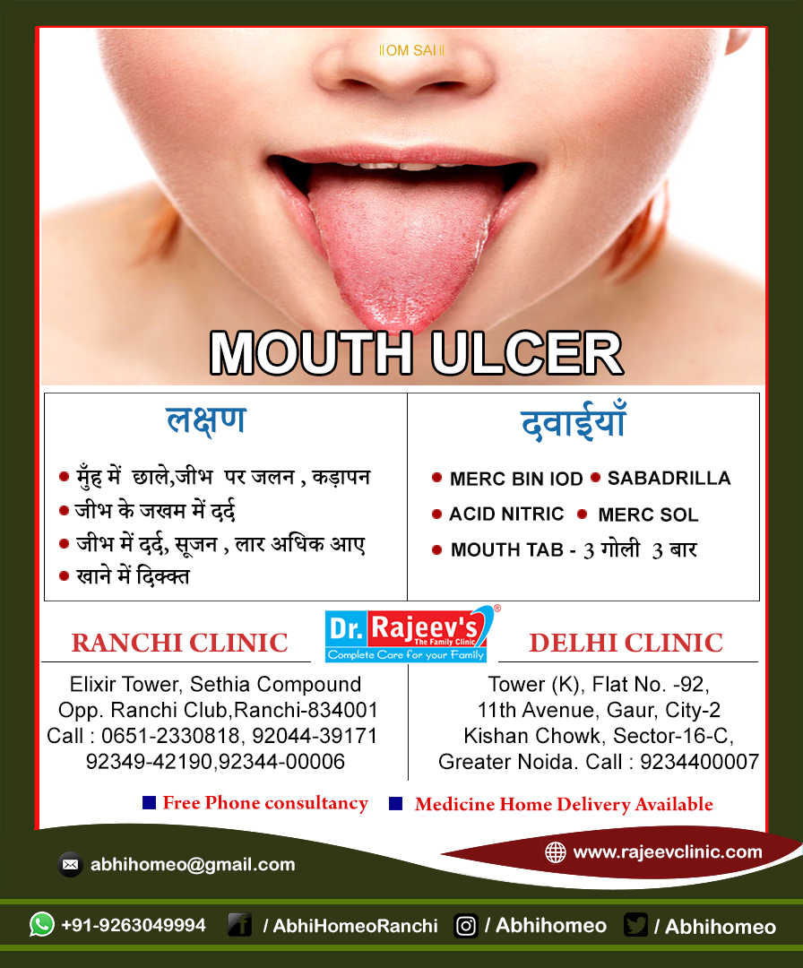 Homeopathy Treatment for Mouth Ulcer in Ranchi/Delhi