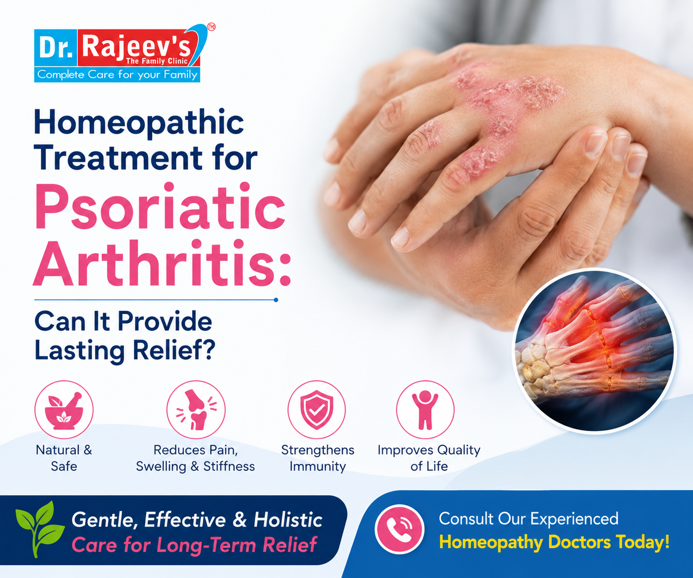Homeopathic Treatment for Psoriatic Arthritis: Can It Provide Lasting Relief?