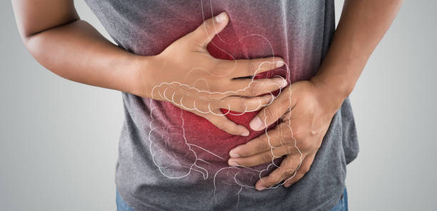 CONSTIPATION - EFFECTIVE TREATMENT FOR CONSTIPATION