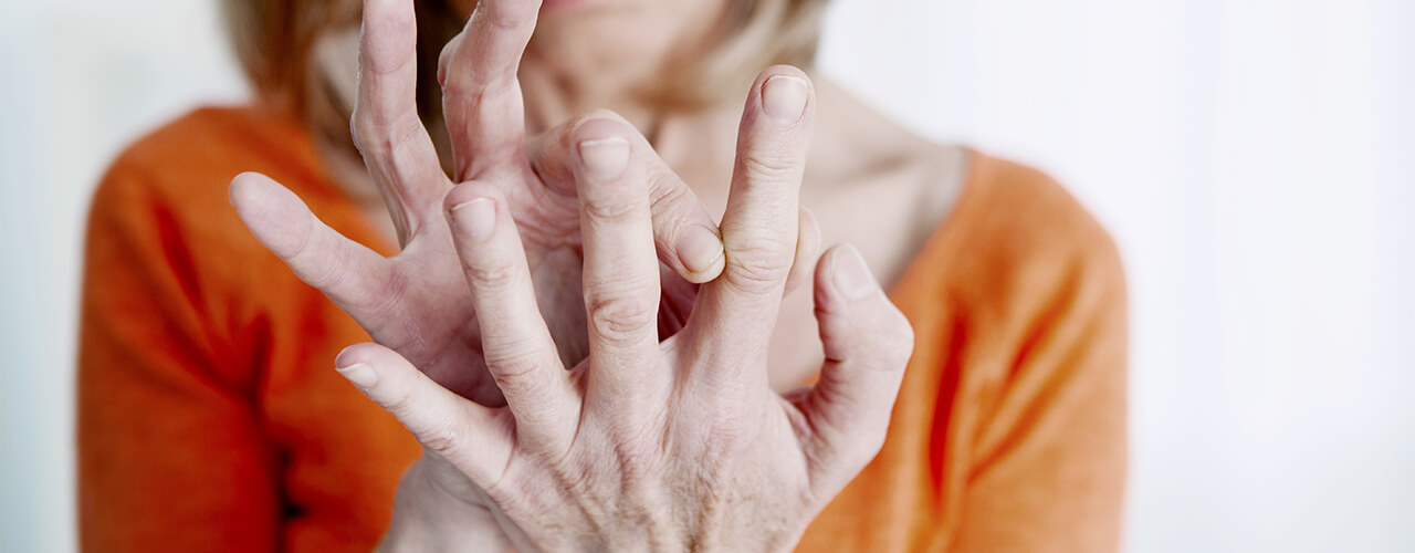 ARTHRITIS TREATMENT IN HOMEOPATHY