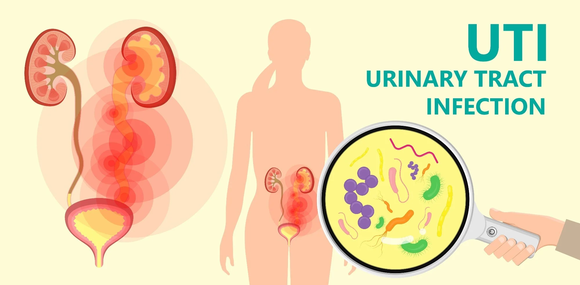 Decrease Risk of UTI By Homoeopathy?