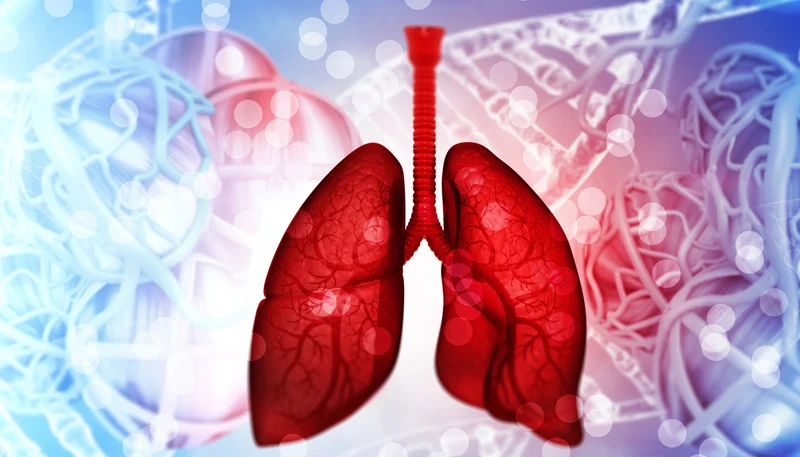TREATMENT OF CYSTIC FIBROSIS IN HOMEOPATHY