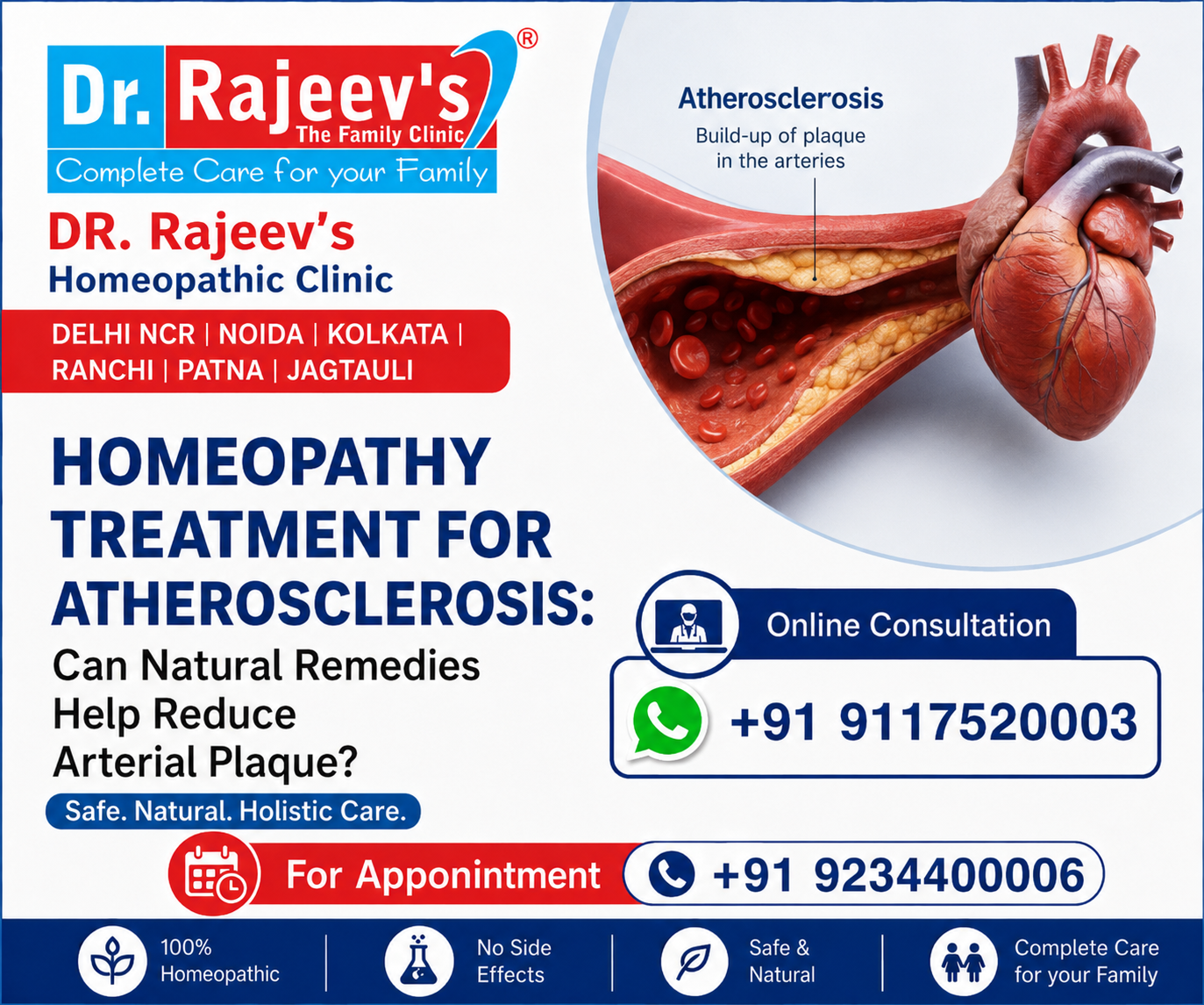 Homeopathy Treatment for Atherosclerosis: Can Natural Remedies Help Reduce Arterial Plaque? 