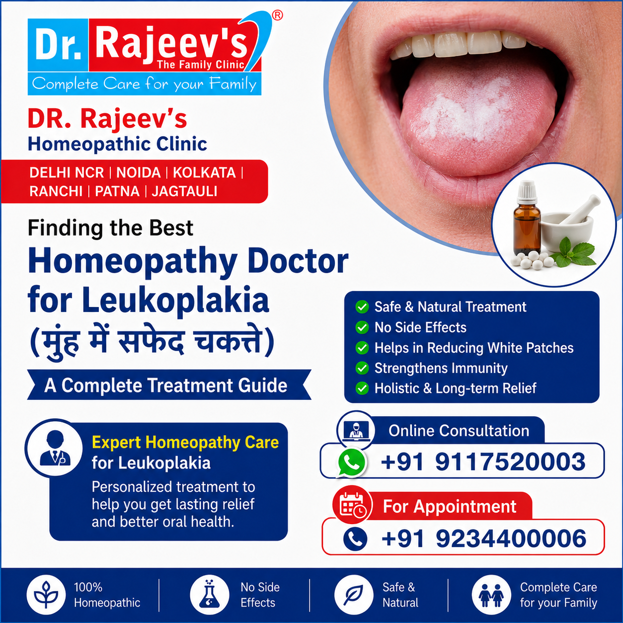  Finding the Best Homeopathy Doctor for Leukoplakia (मुंह में सफेद चकत्ते): A Complete Treatment Guide