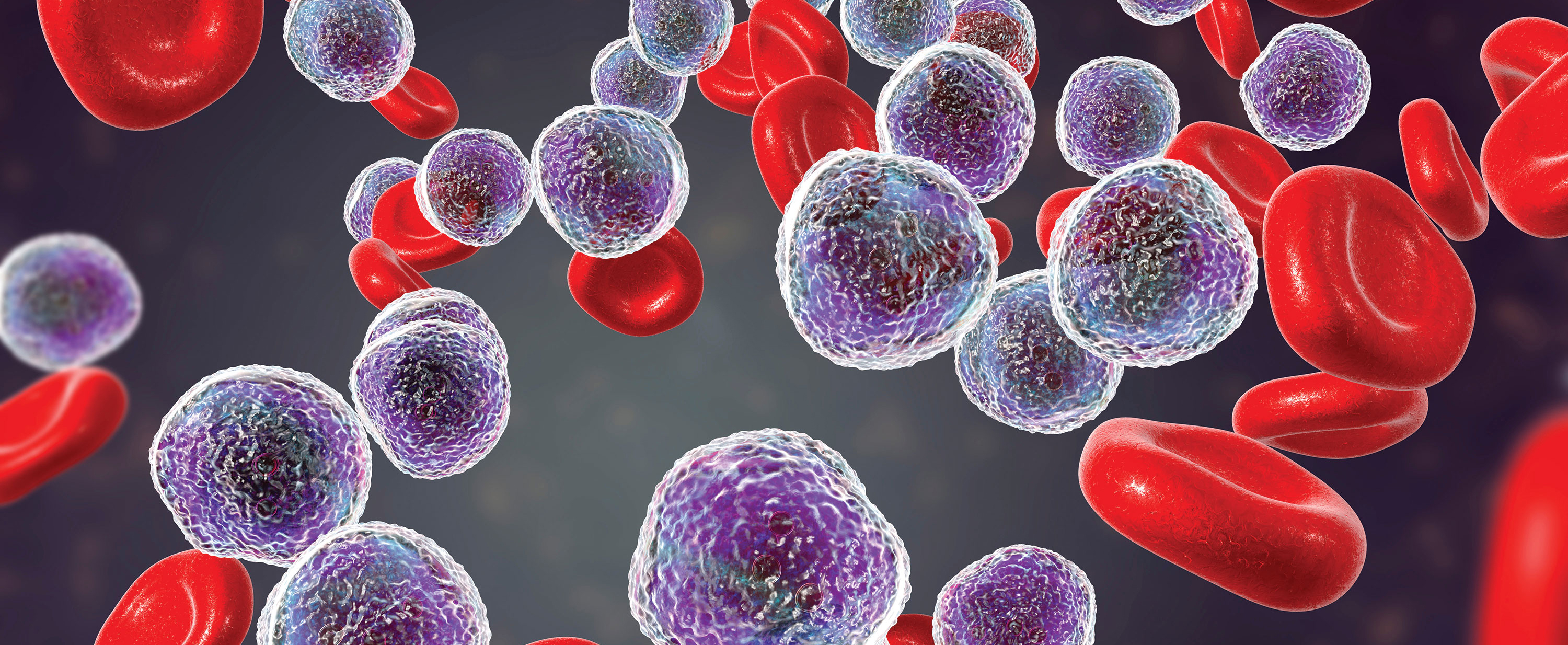 CHRONIC LYMPHOCYTIC LEUKAEMIA (CLL) AND ROLE OF HOMOEOPATHIC MODE OF TREATMENT ON IT