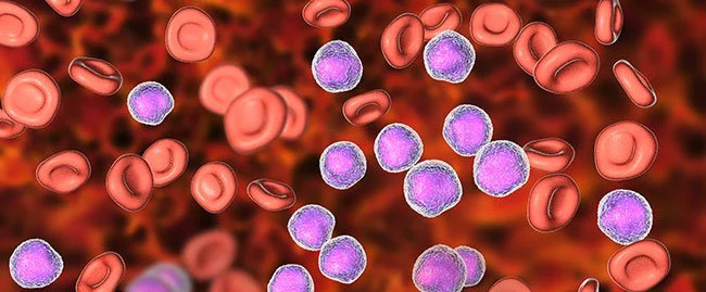 MYELODYSPLASTIC SYNDROMES (MDS) AND HOMOEOPATHY