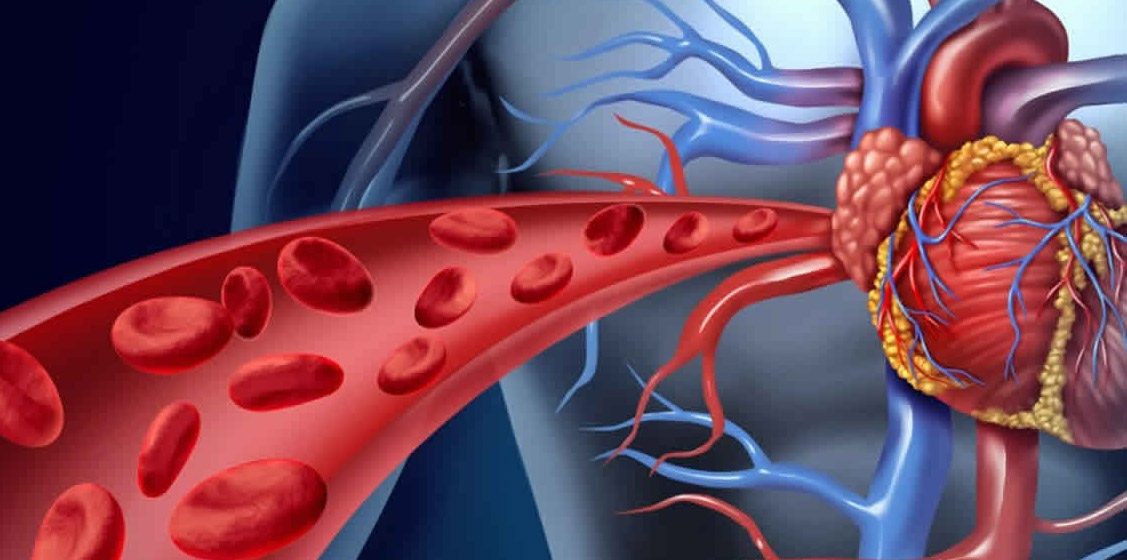 HYPERVISCOSITY SYNDROME AND EFFECT OF HOMOEOPATHIC REMEDIES ON IT