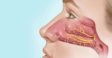 Treatment of Rhinitis through Homeopathy