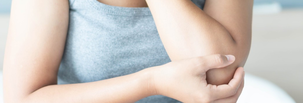 CUBITAL TUNNEL SYNDROME (ULNAR NEUROPATHY)