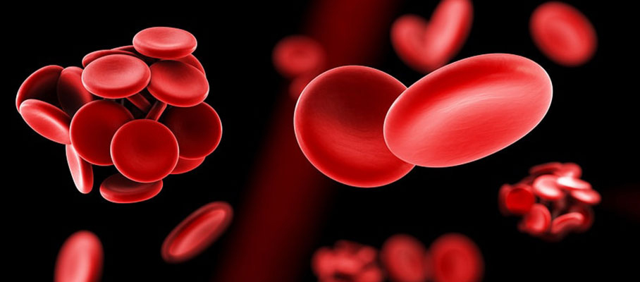 THROMBOPHILIA AND HOW HOMOEOPATHIC REMEDIES MANAGE IT