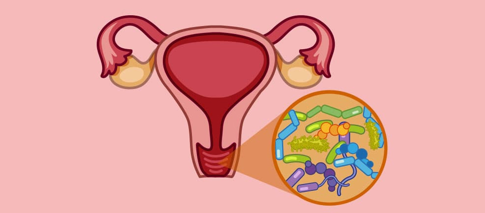VAGINITIS AND EFFECT OF HOMOEOPATHIC MEDICINES ON IT