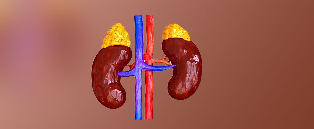 ADDISON'S DISEASE AND IT'S HOMOEOPATHIC APPROACH