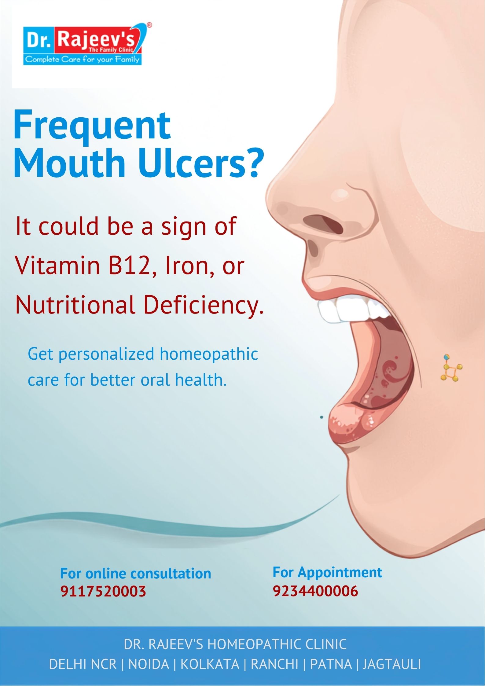 Mouth Ulcers and Nutritional Deficiencies: Symptoms, Causes and Best Homeopathic Treatment for Oral Health