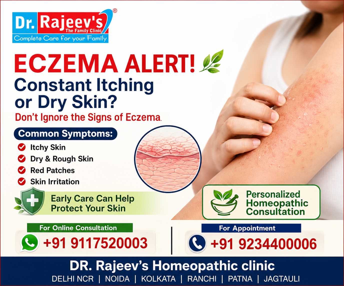 Eczema: Understanding Symptoms, Causes, Treatment & Skin Care